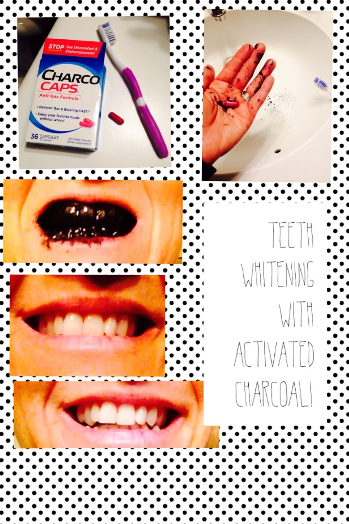 Teeth whitening with activated charcoal capsules!!